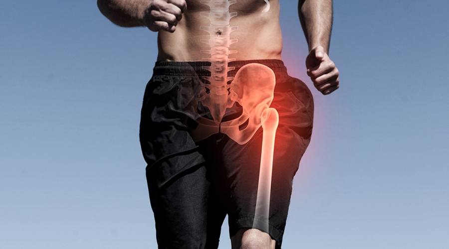 7 Consigli per salvare anca e ginocchio dall’artrosi ed evitare l’intervento di protesi